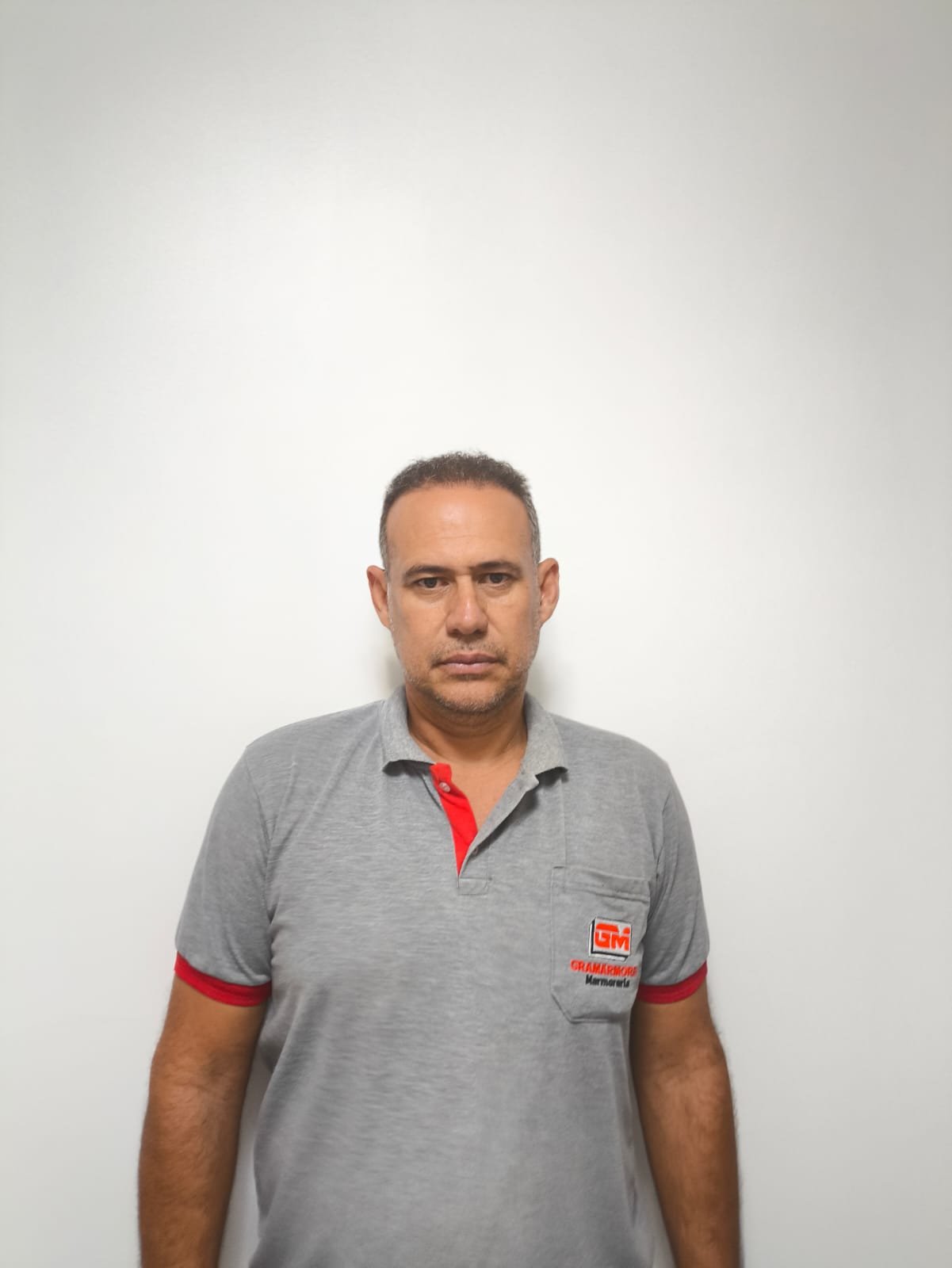 Mesmo paciente Duo Capilare depois do transplante capilar, com densidade recuperada